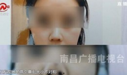 南昌医美爆料事件视频最新,真相触目惊心